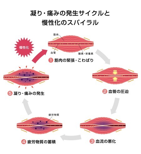 当院のリラクゼーション施術